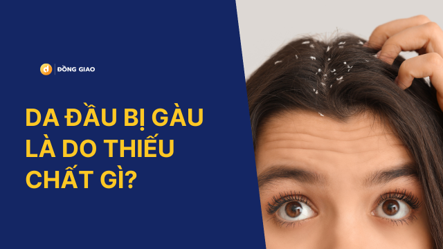 Da đầu bị gàu là thiếu chất gì?