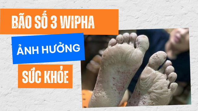 Bão số 3 Wipha